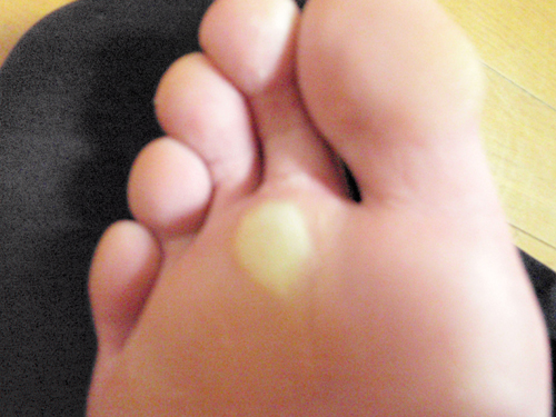 桃園機場と足の裏